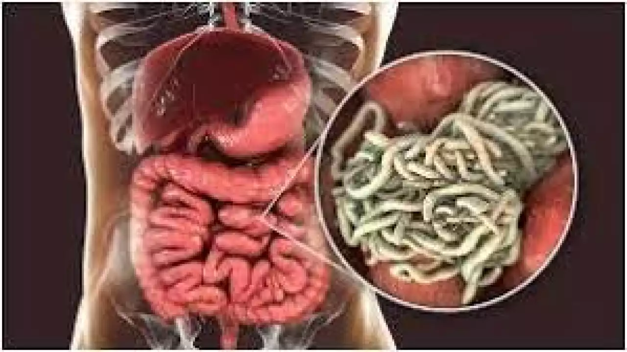 Гельминтоздардан абайлау керек!